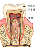 牙疼为什么那么疼,牙痛为什么那么痛,牙痛为什么很痛